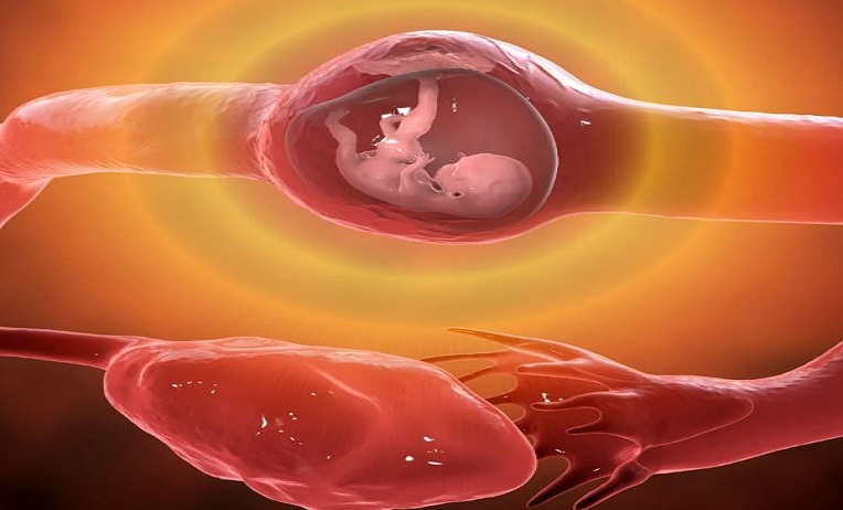 كيف اعرف أن الحمل خارج الرحم؟