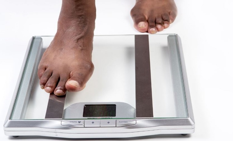 ما هو الوزن الذي يعتبر سمنة؟